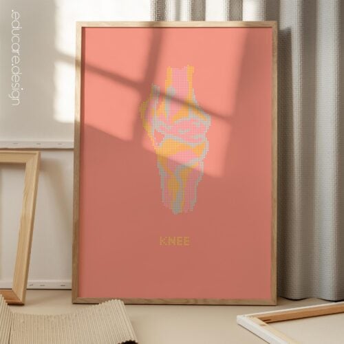 Knee Pop Art for medical offices