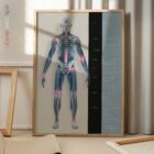 Arthrose planche anatomique pour cabinets et cliniques