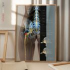 Sciatique et Sténose planche anatomique pour cabinets et cliniques