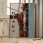 Complejo de Subluxación Vertebral lámina anatómica para clínicas y consultas