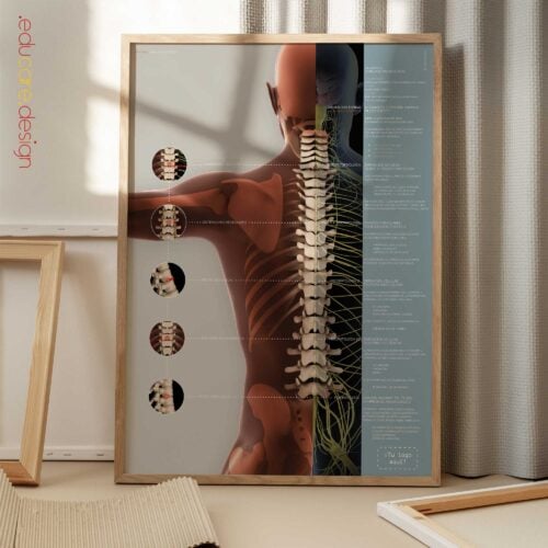 Complejo de Subluxación Vertebral