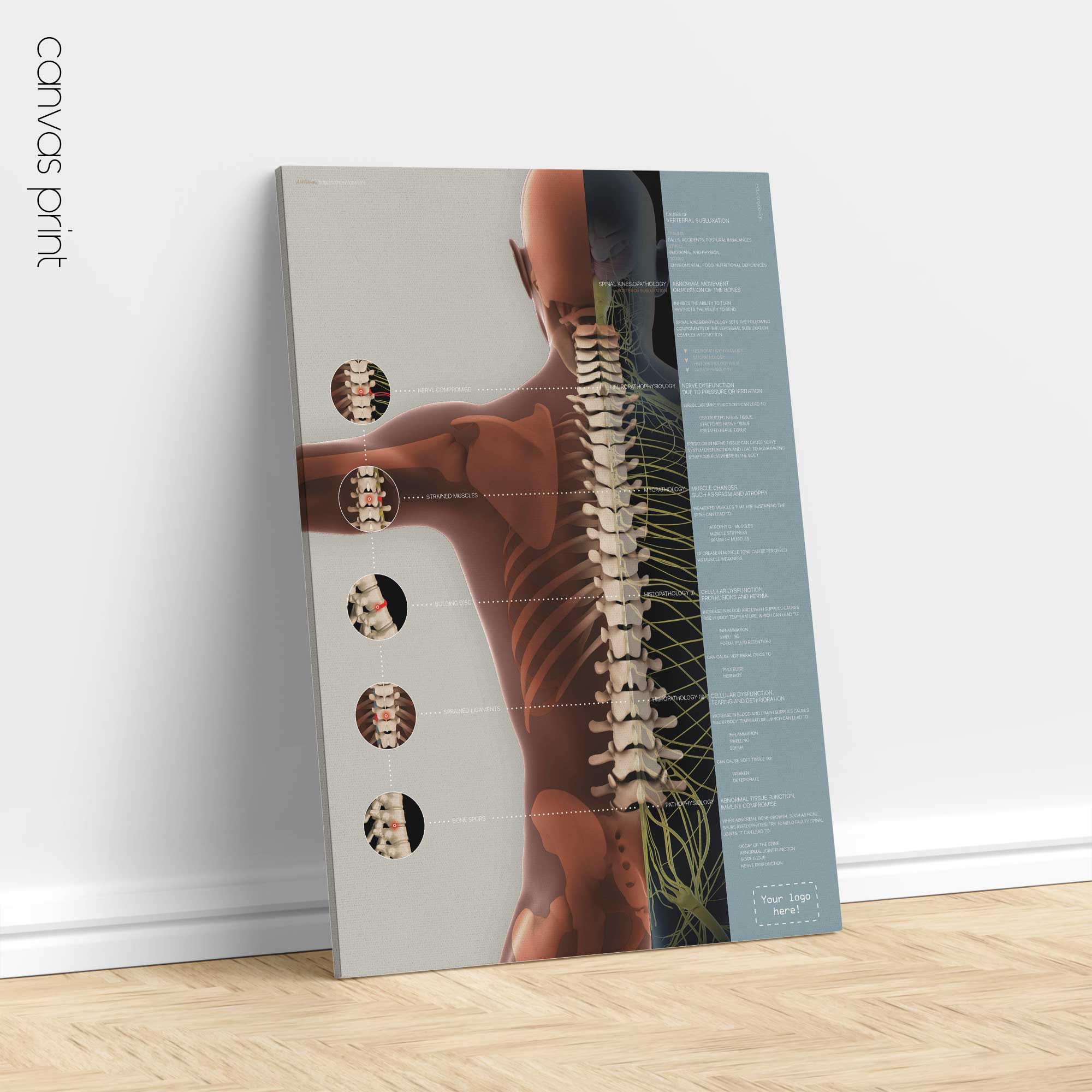 Vertebral Subluxation Complex