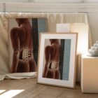 Spinal Subluxation Effects Artwork