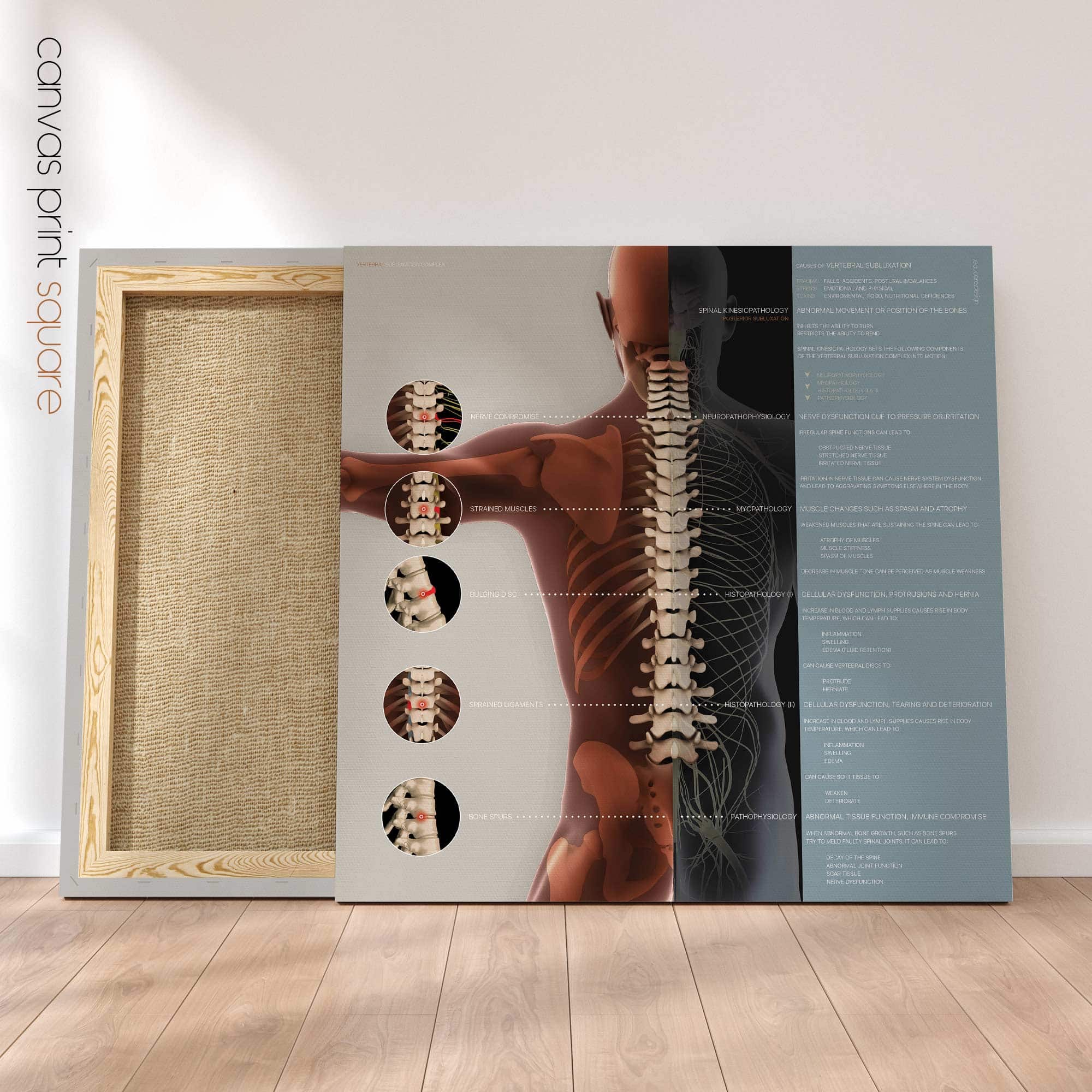 Vertebral Subluxation Complex