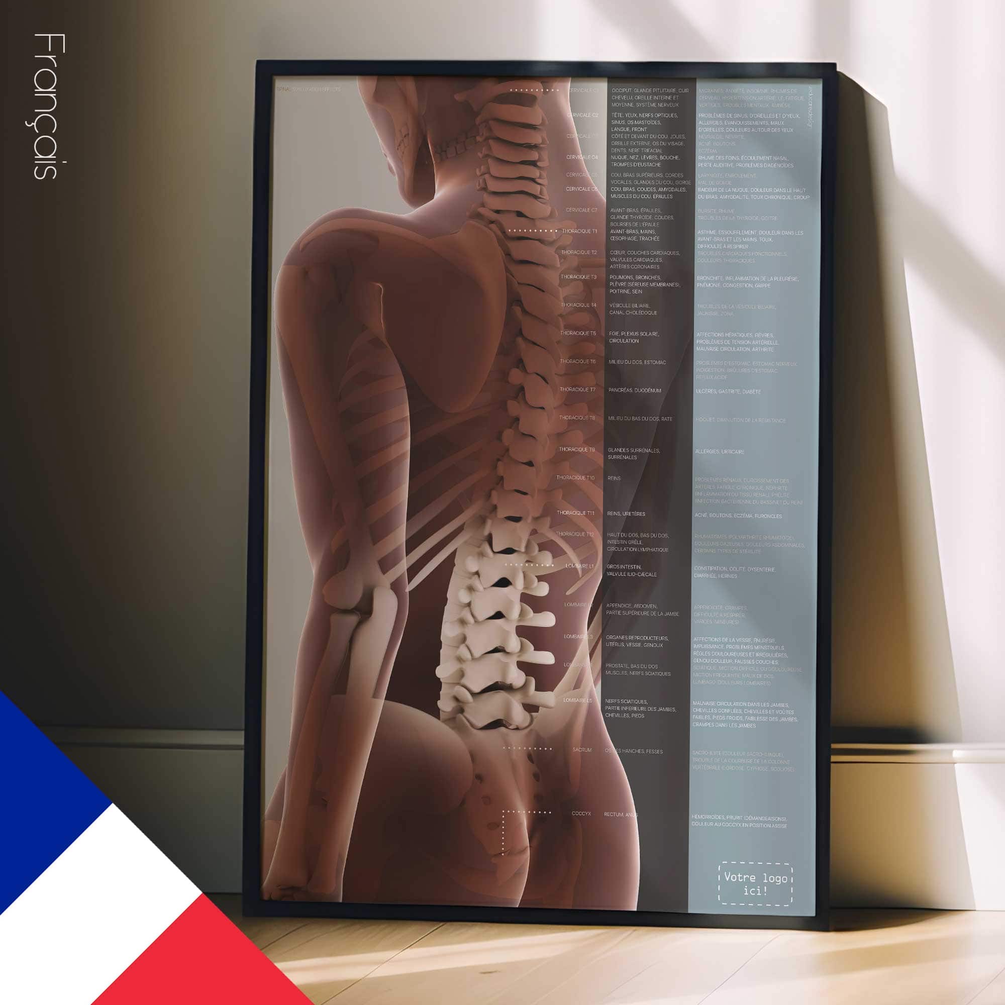 Subluxation vertébrale