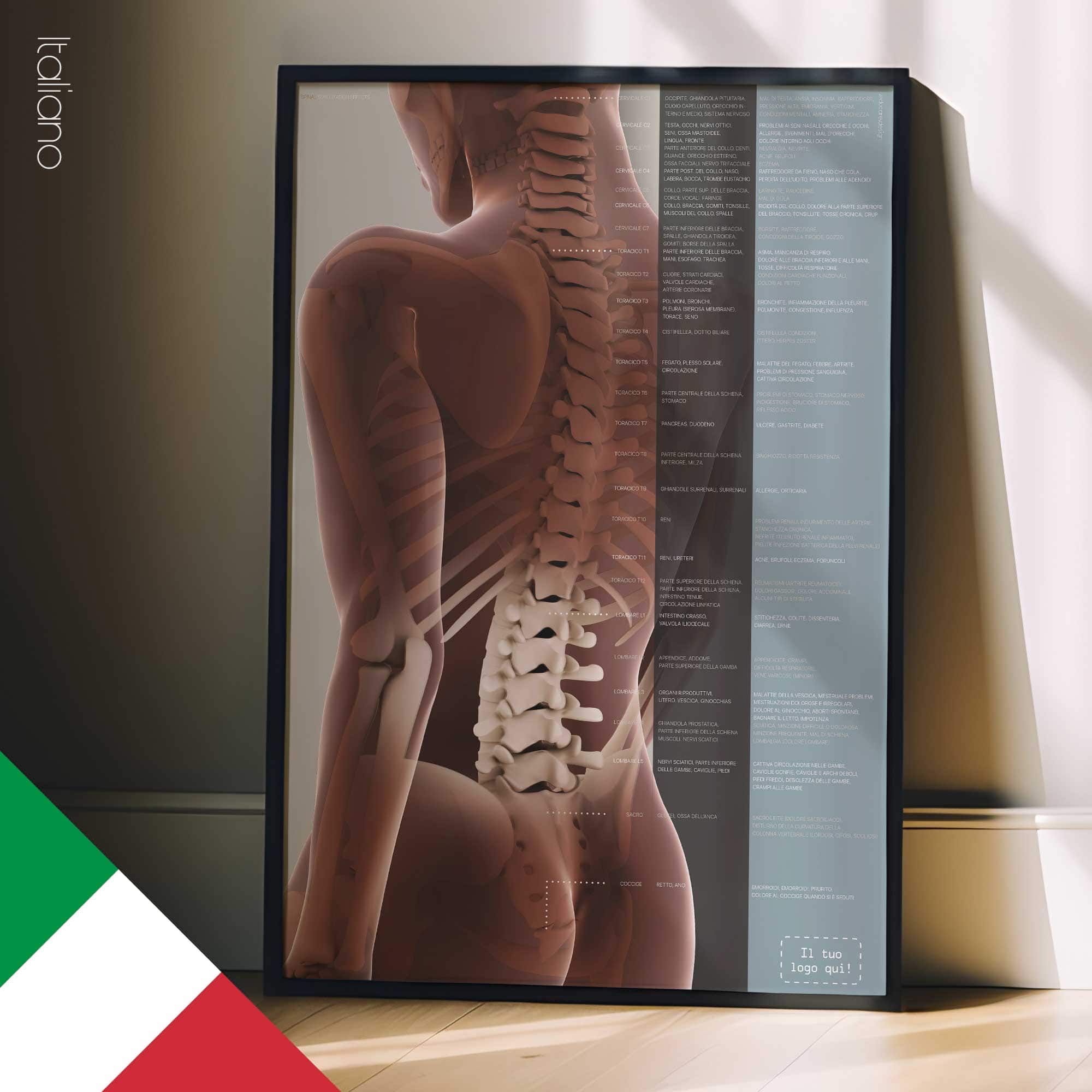 Sublussazione Spinale