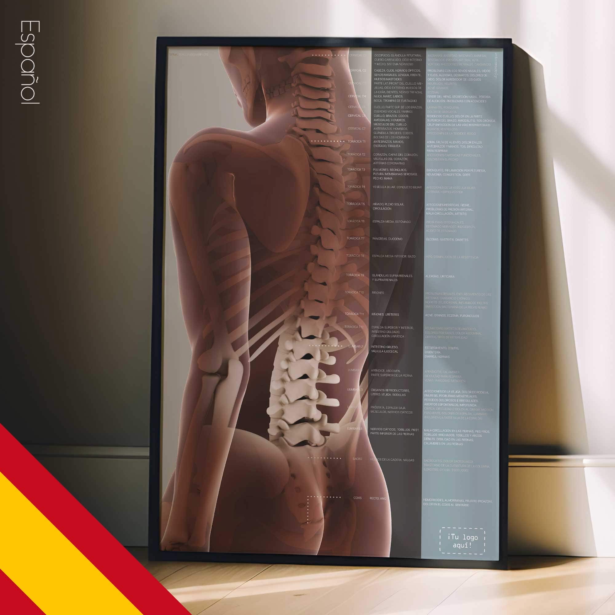 Subluxación Espinal