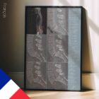 Spondylolisthesis – educare.design Spondylolisthesis