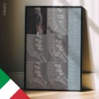 Spondylolisthesis – educare.design Spondylolisthesis