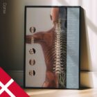 Vertebral Subluxation Complex