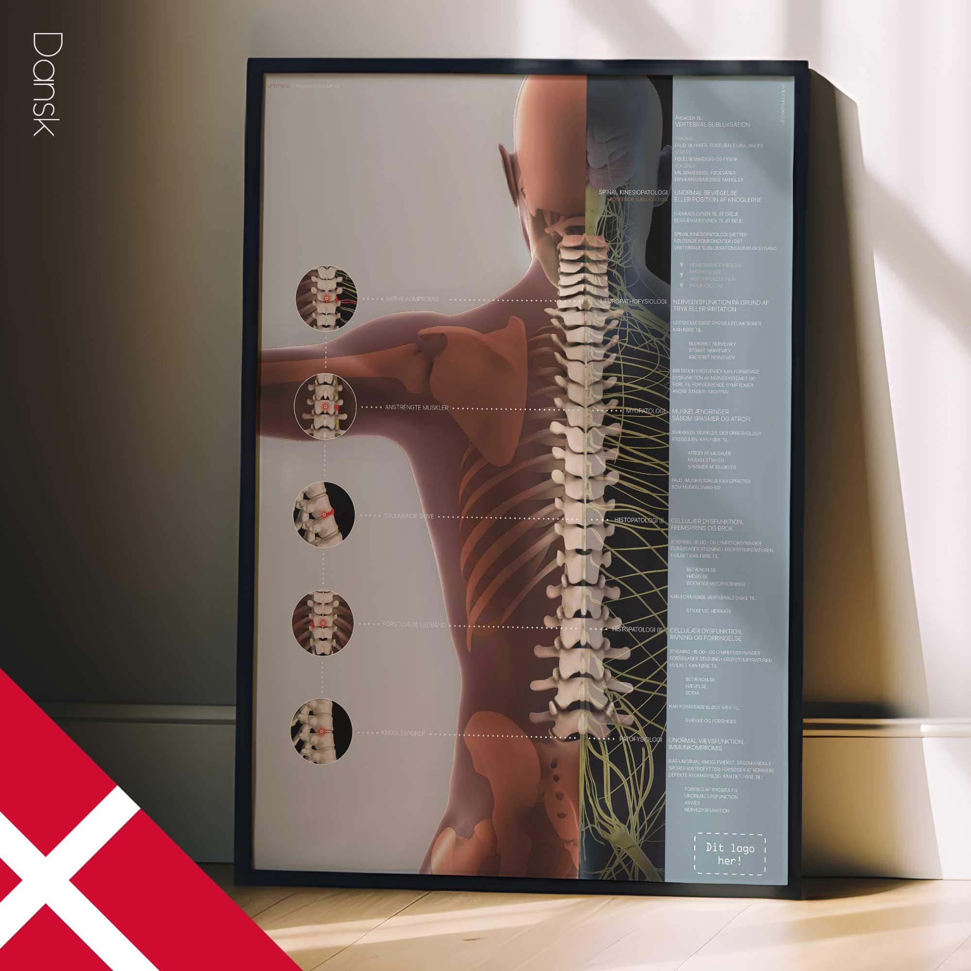 Vertebral Subluxation Complex
