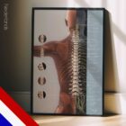 Vertebrale Subluxatiecomplex