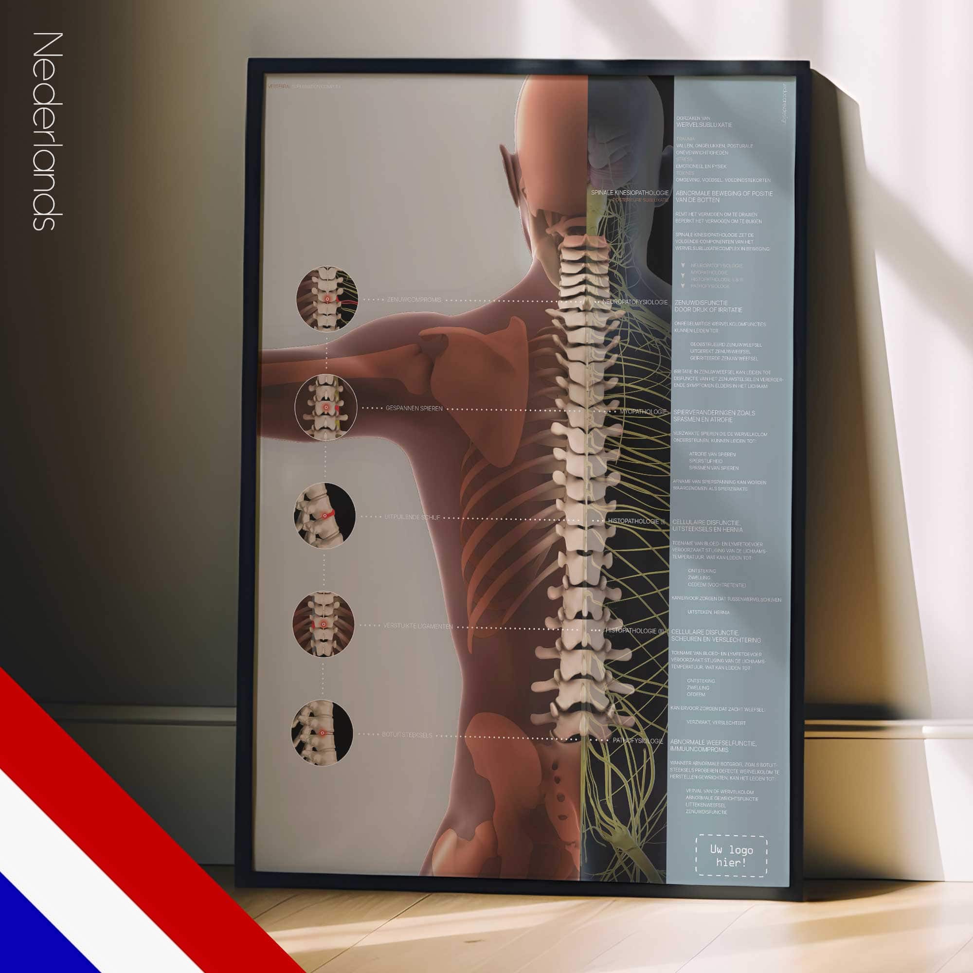 Vertebrale Subluxatiecomplex