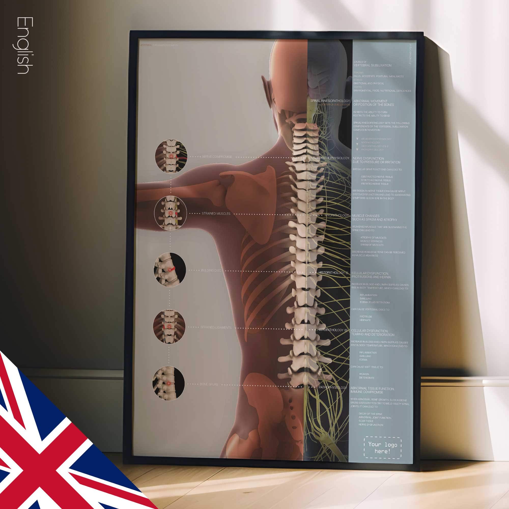 Vertebral Subluxation Complex