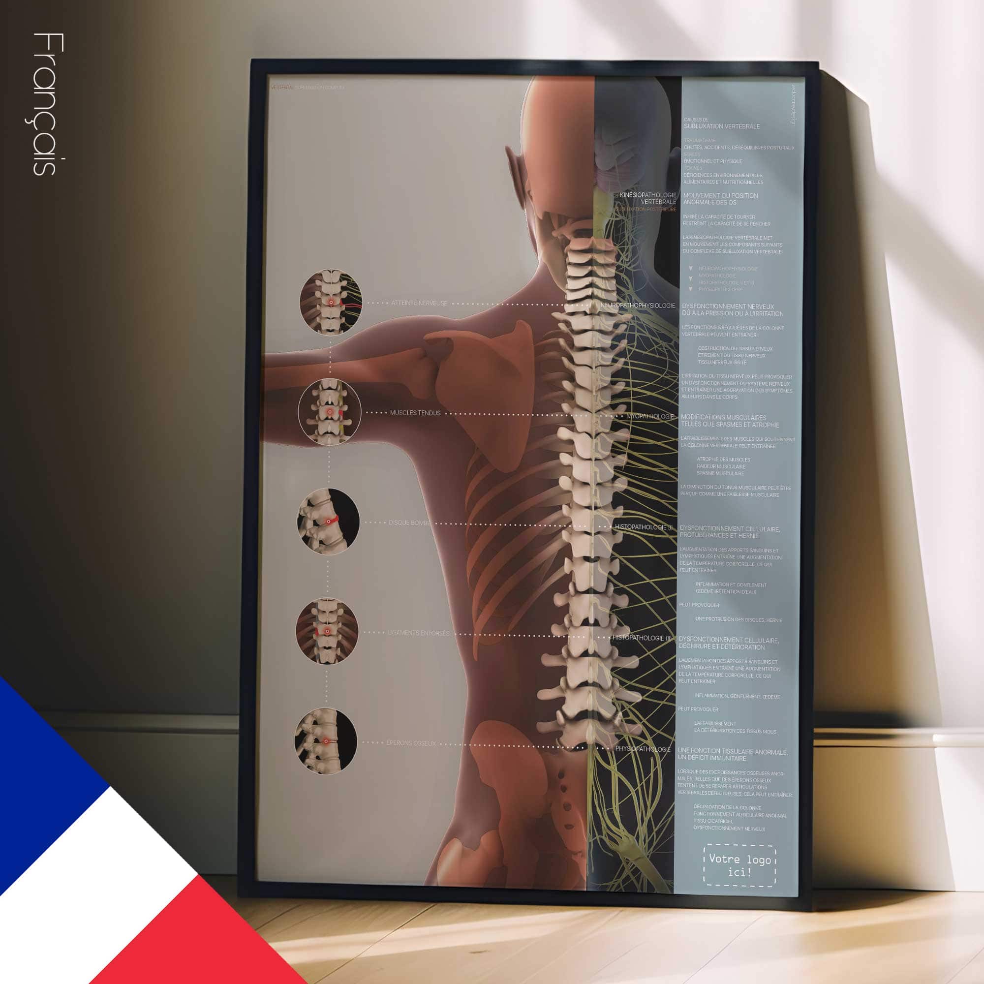 Complexe de Subluxation Vertébrale