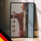 Wirbelsubluxationskomplex