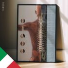 Complesso di Sublussazione Vertebrale