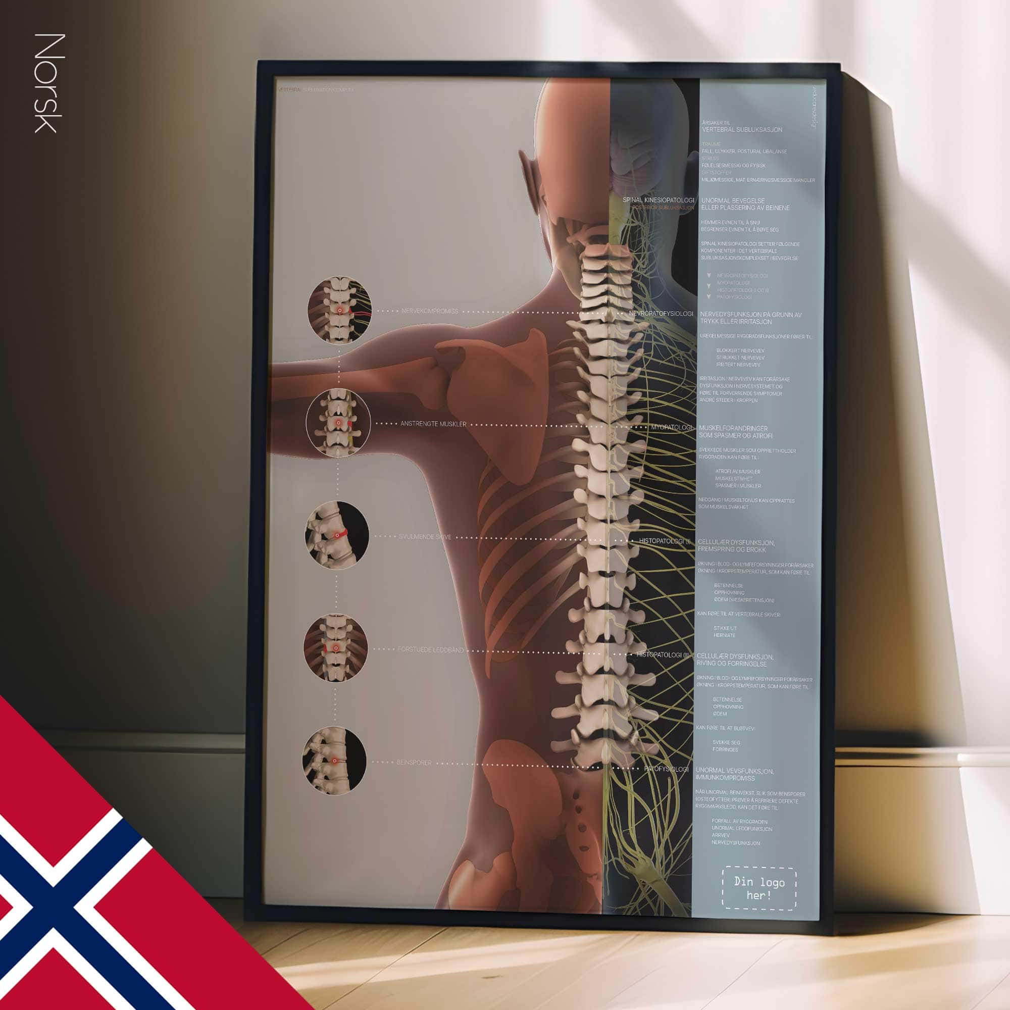 Vertebral Subluxation Complex