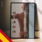 Complejo de Subluxación Vertebral