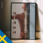 Vertebral Subluxation Complex