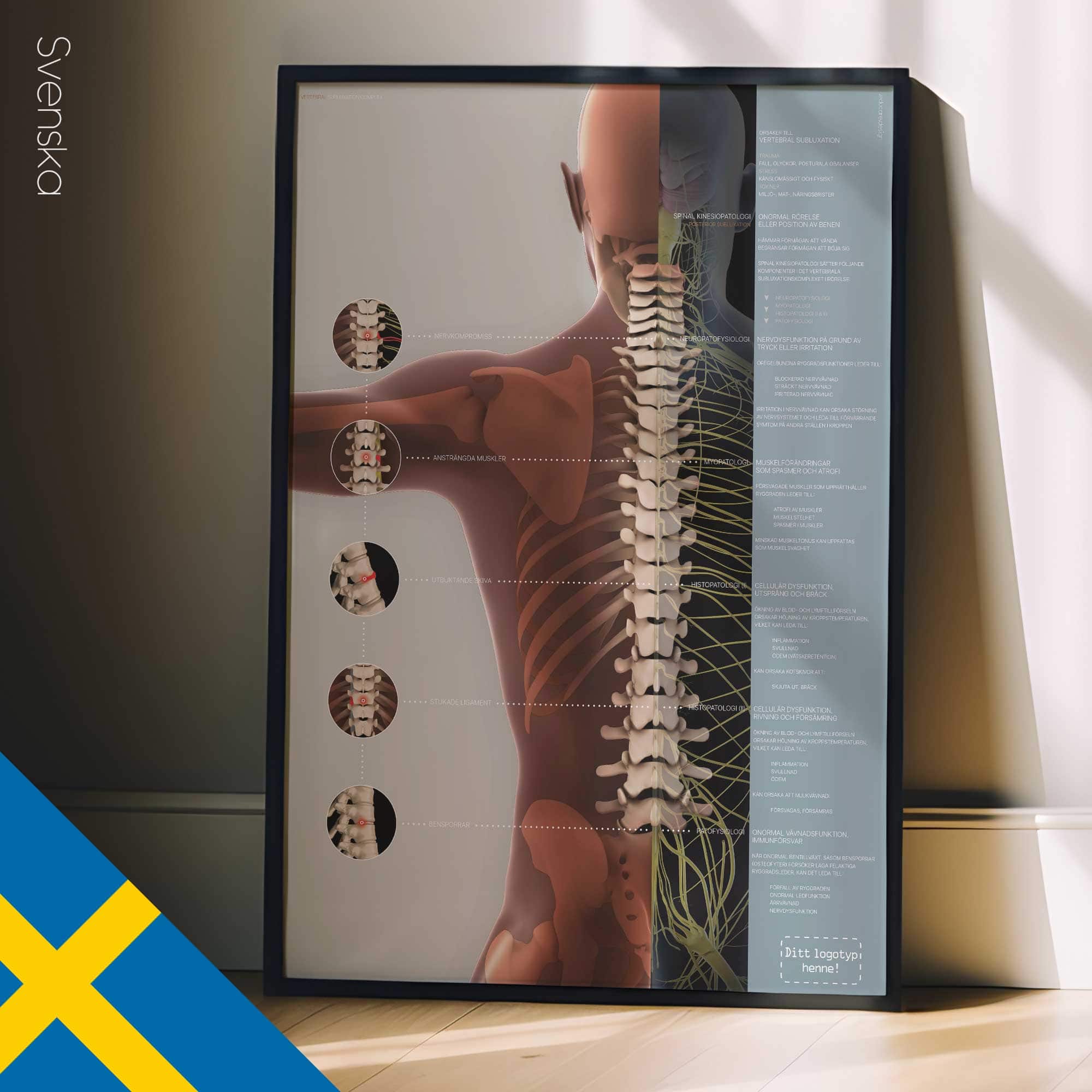 Vertebral Subluxation Complex