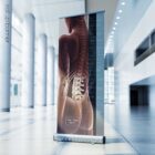 Spinal Subluxation Effects Artwork