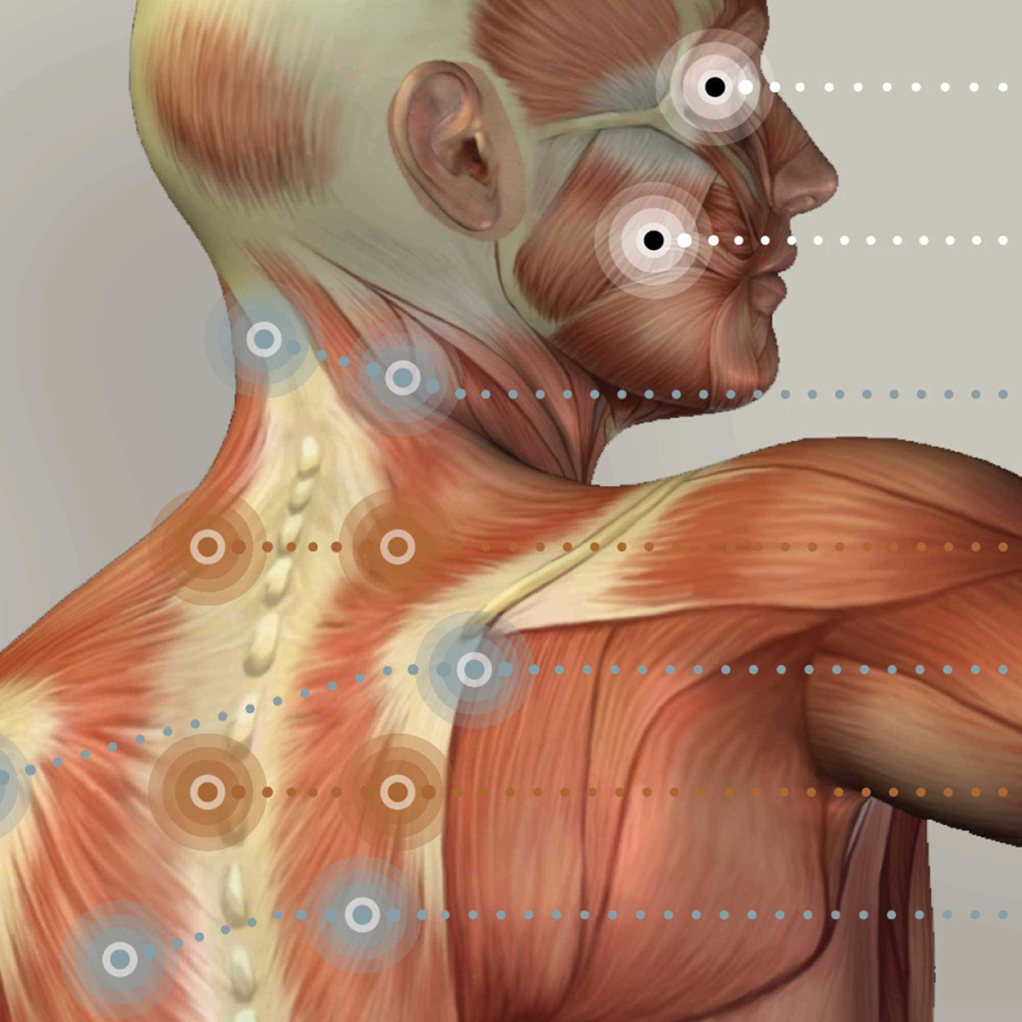 Fibromyalgia with Hormonal and Nervous System Connections