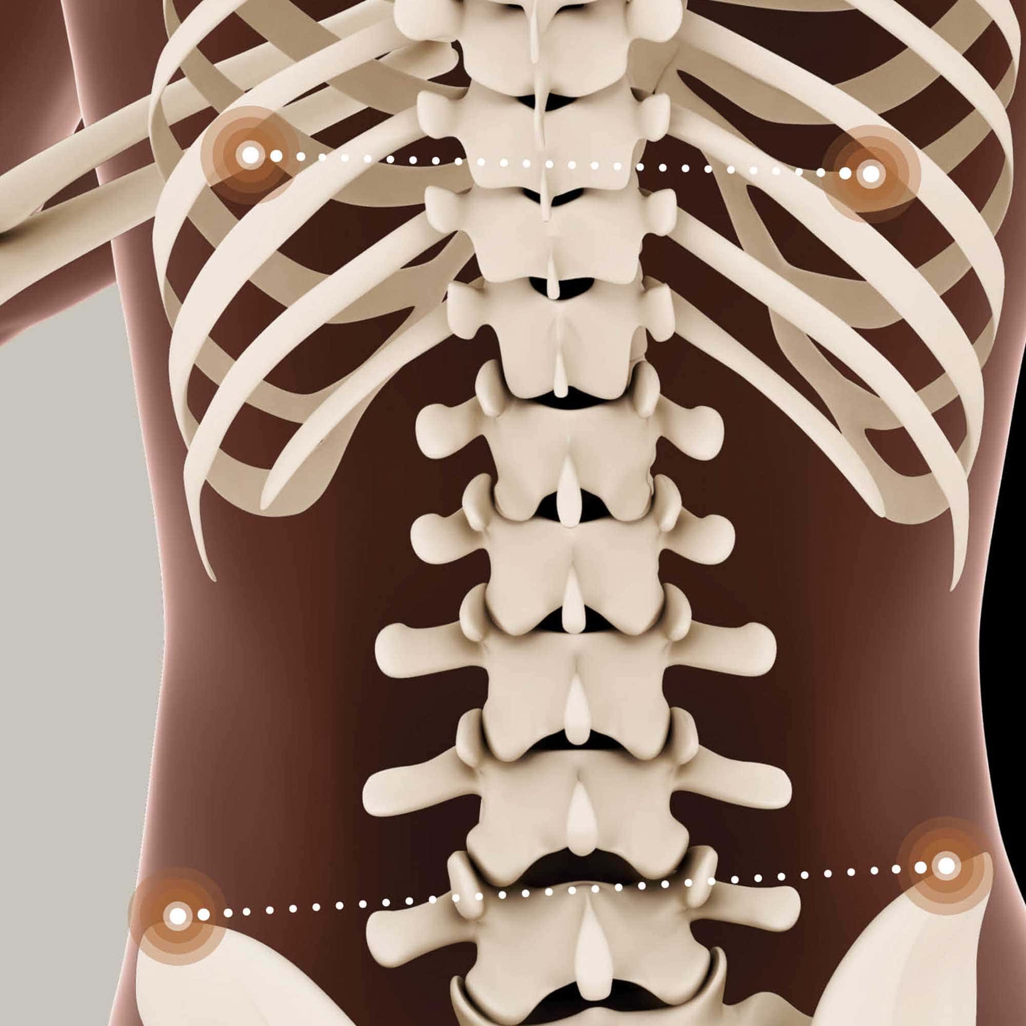 Postural Imbalance and Consequences