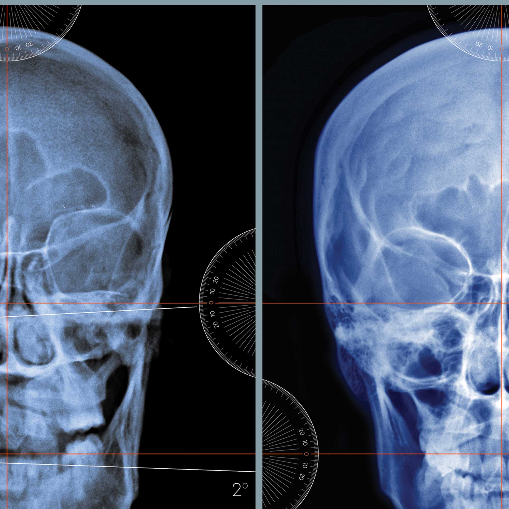 Male Reproductive System