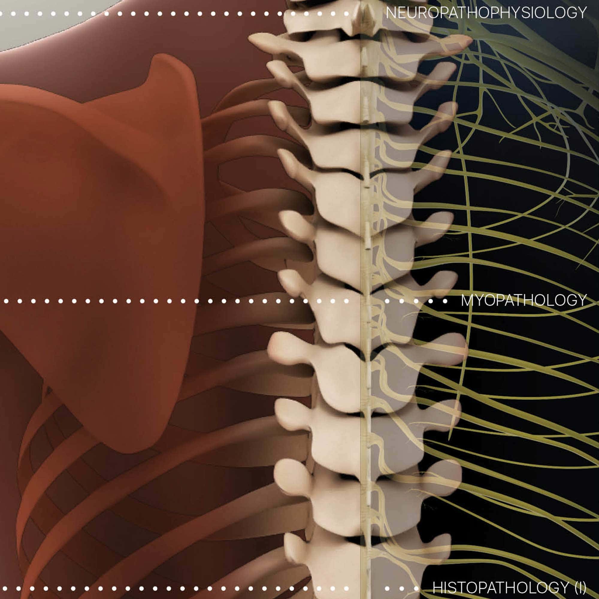 Vertebral Subluxation Complex