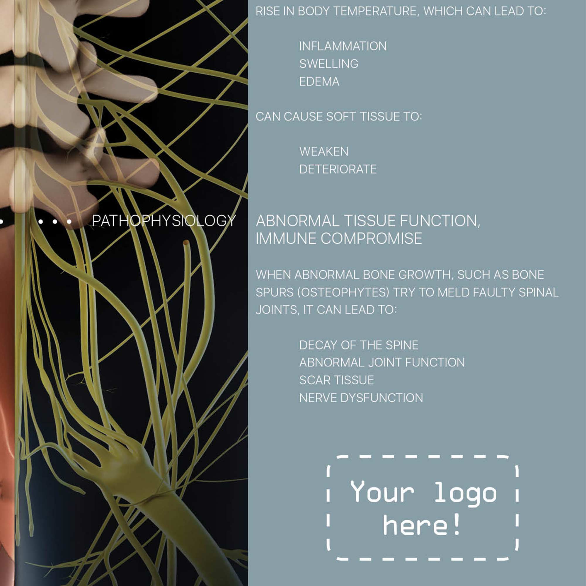 Vertebral Subluxation Complex