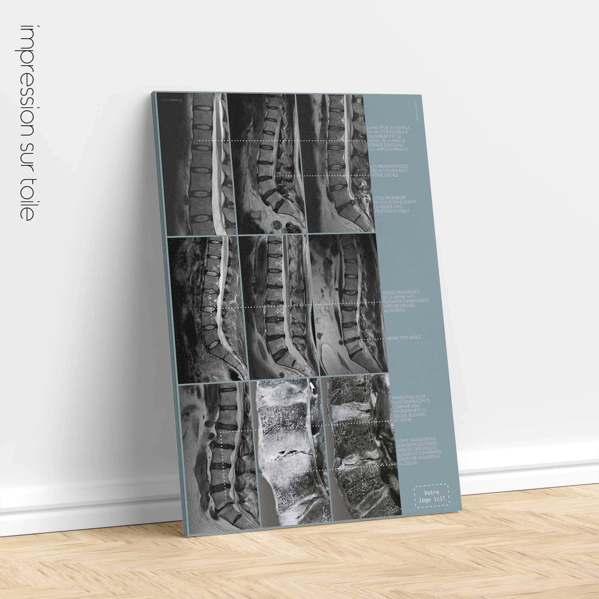 Pathologie lombaire artwork from educare.design