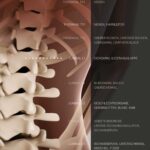 Subluxation der Wirbelsäule