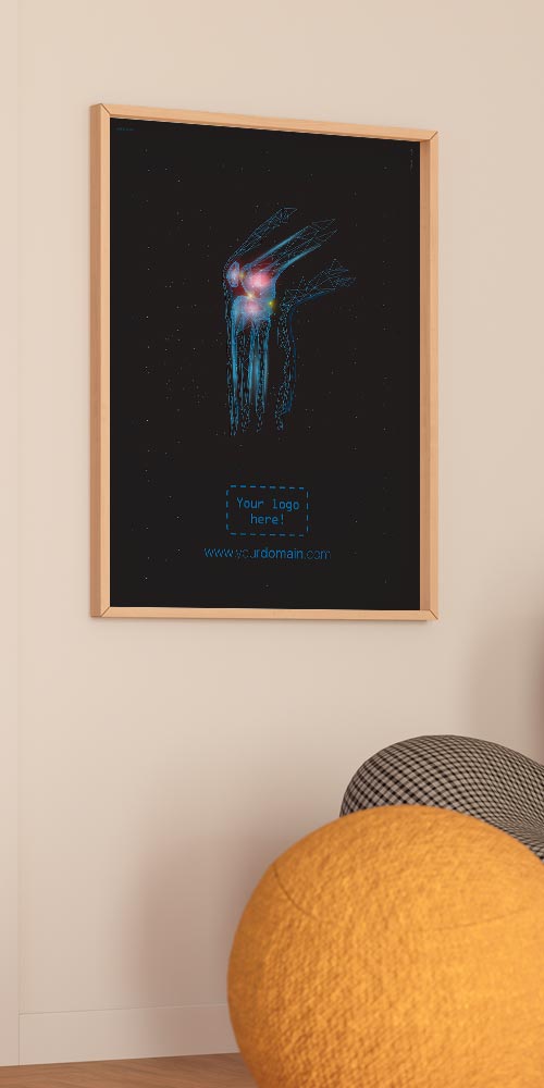 minimal bursitis main – Premium Anatomy Chart by educare.design