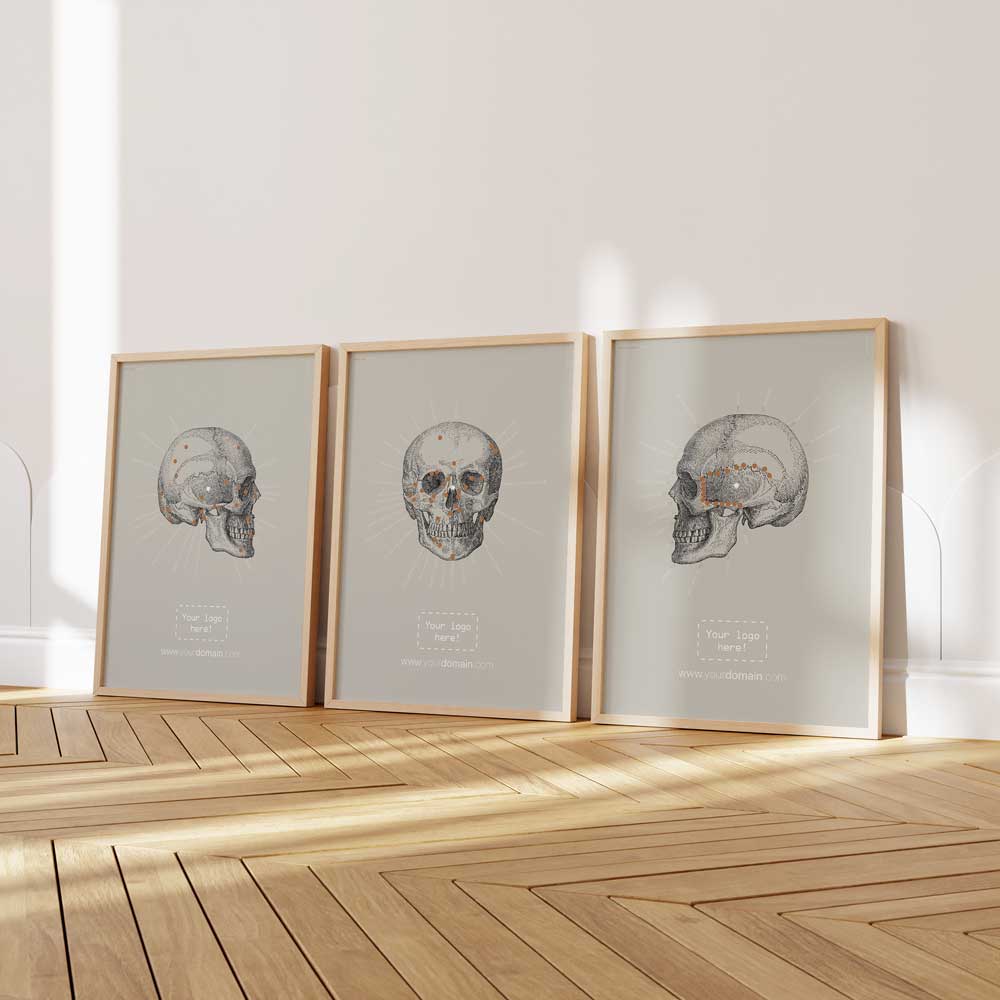 Sphénoïde temporal vintage, TS-Line