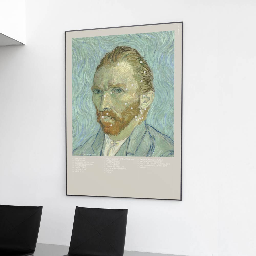 Van Gogh & Lateral Cranial Bones