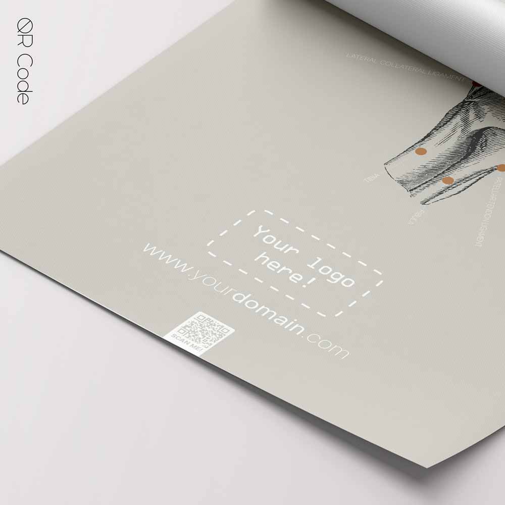 Knee Anatomy, Lateral — Planche anatomique