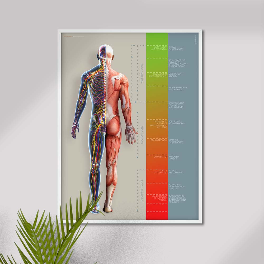 A2 poster without customisation