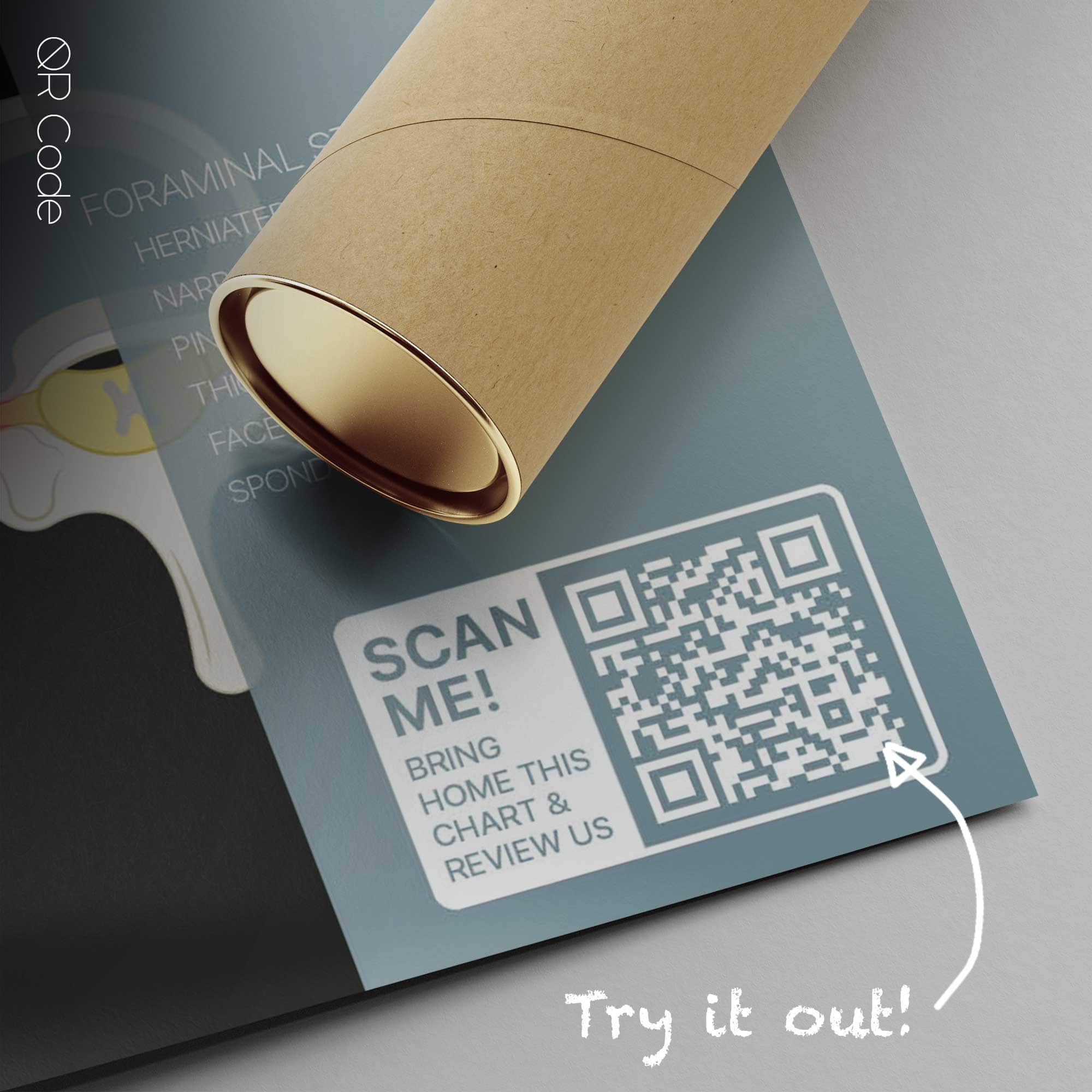 Sciatica and Stenosis — Anatomy Chart