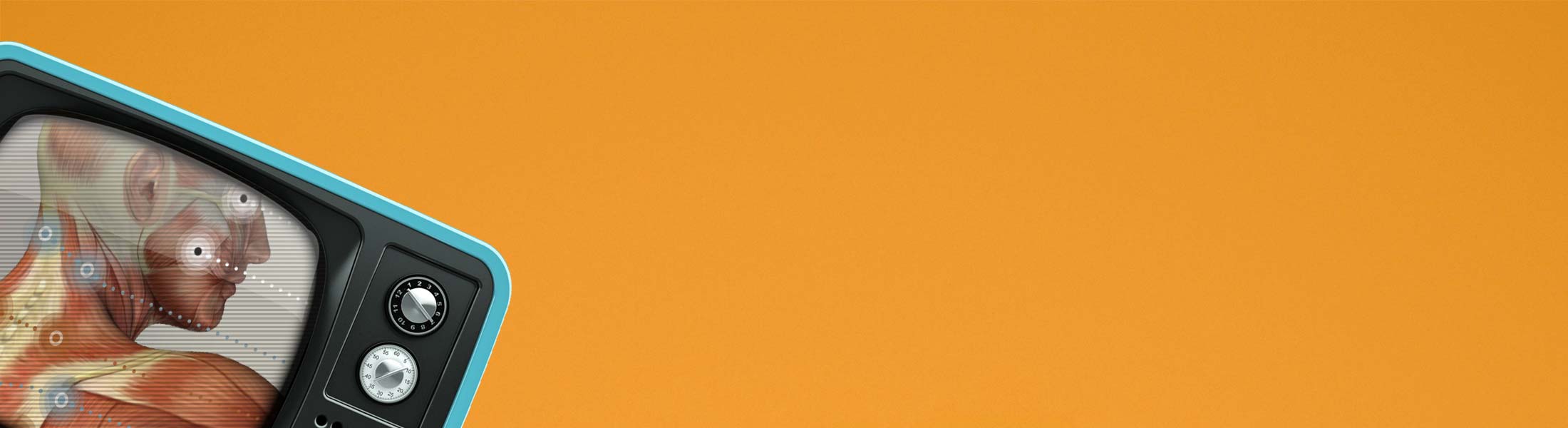 Video of Fibromyalgia