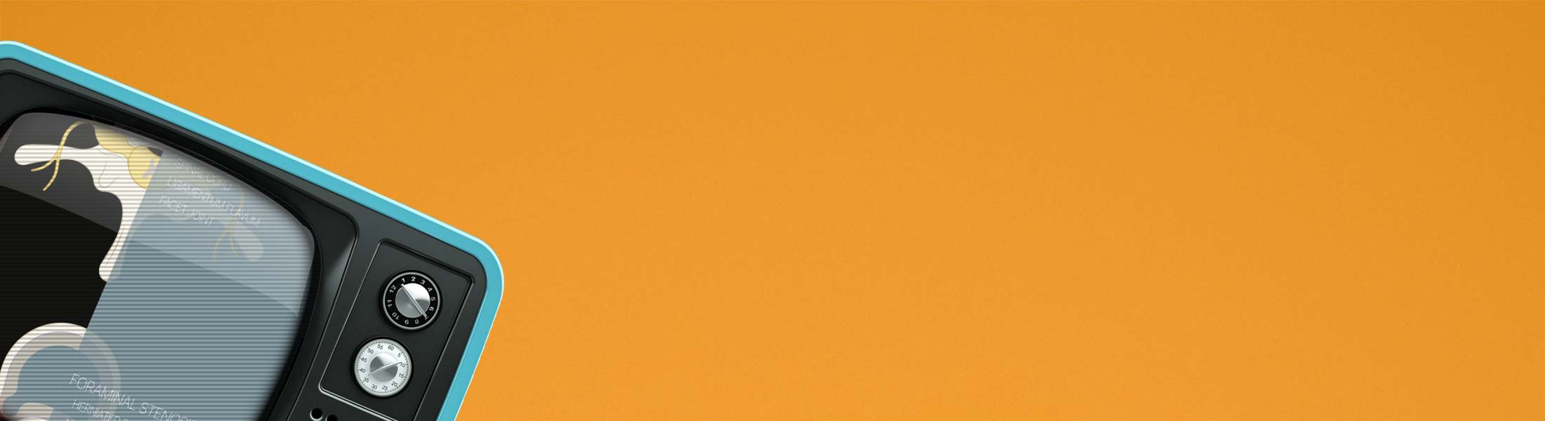 Video of Sciatica and Stenosis