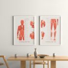 The Myofascial Trigger Points Set anatomy chart for clinics