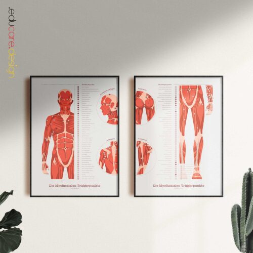 Übungen für den Oberen Rücken Anatomie-Chart für Praxen und Kliniken
