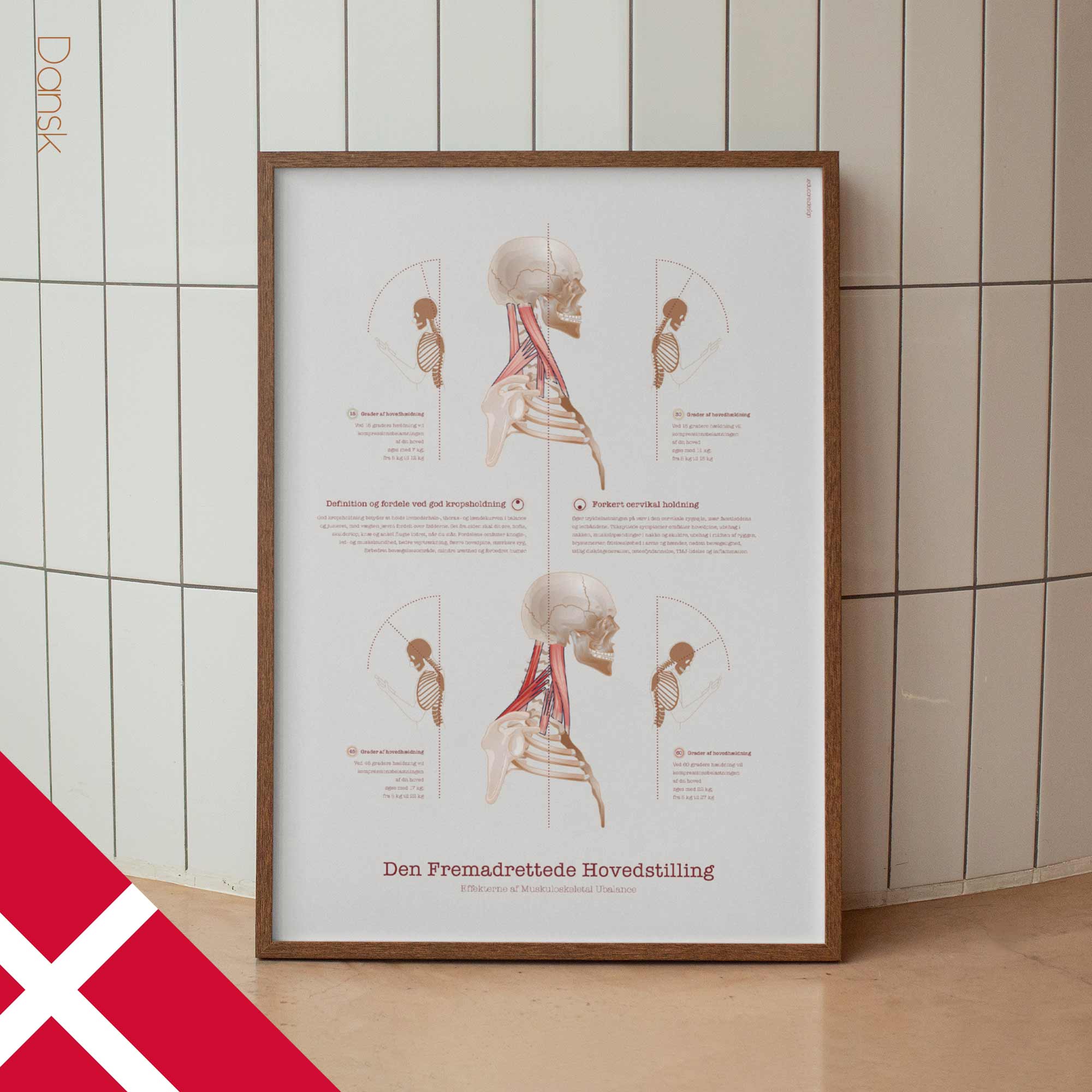 Forward Head Posture chart