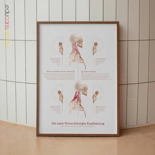 Kopfschmerztypen Anatomie-Chart für Praxen und Kliniken Kopfschmerztypen Anatomie-Chart für Praxen und Kliniken
