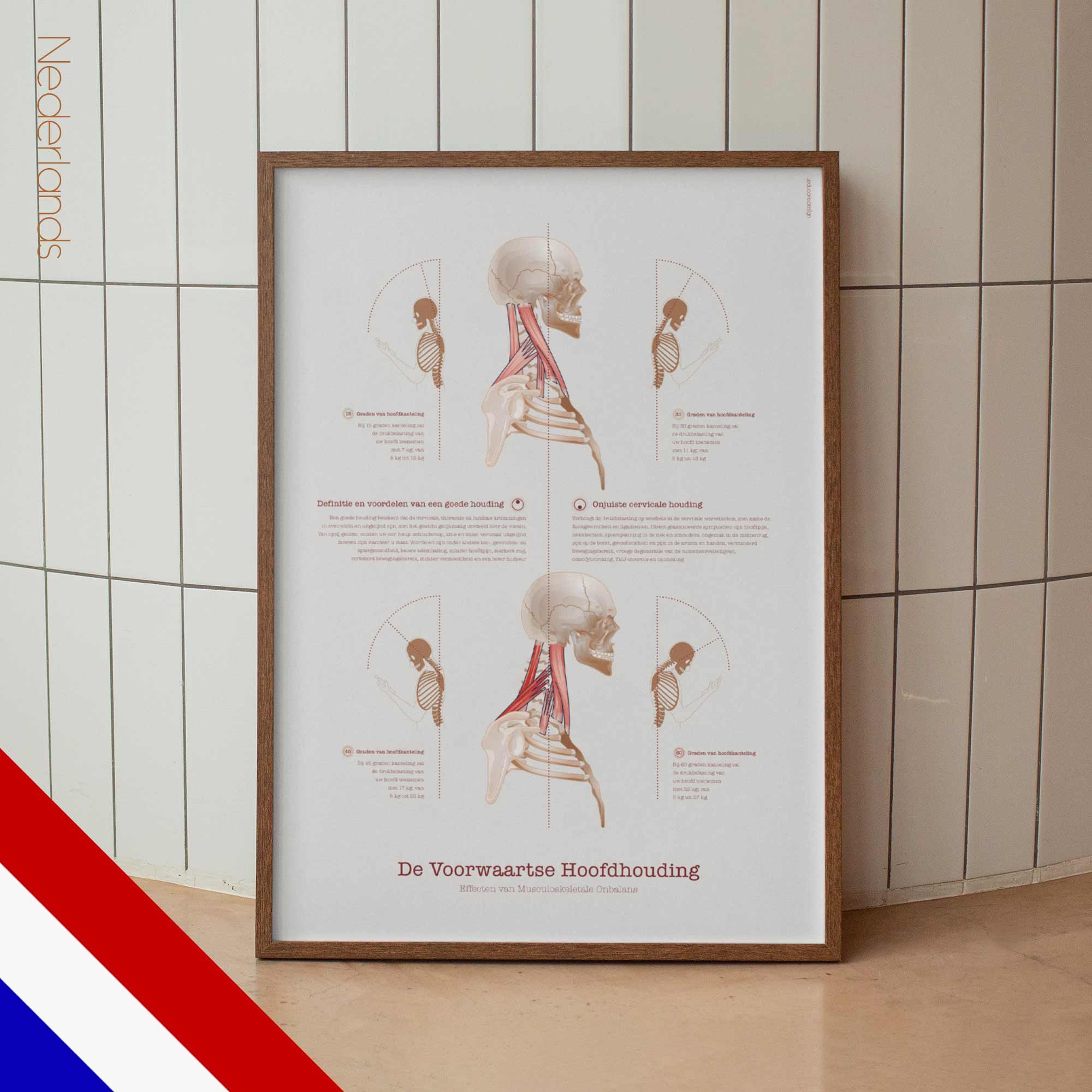 Forward Head Posture chart