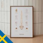 Diskbråck anatomidiagram för kliniker