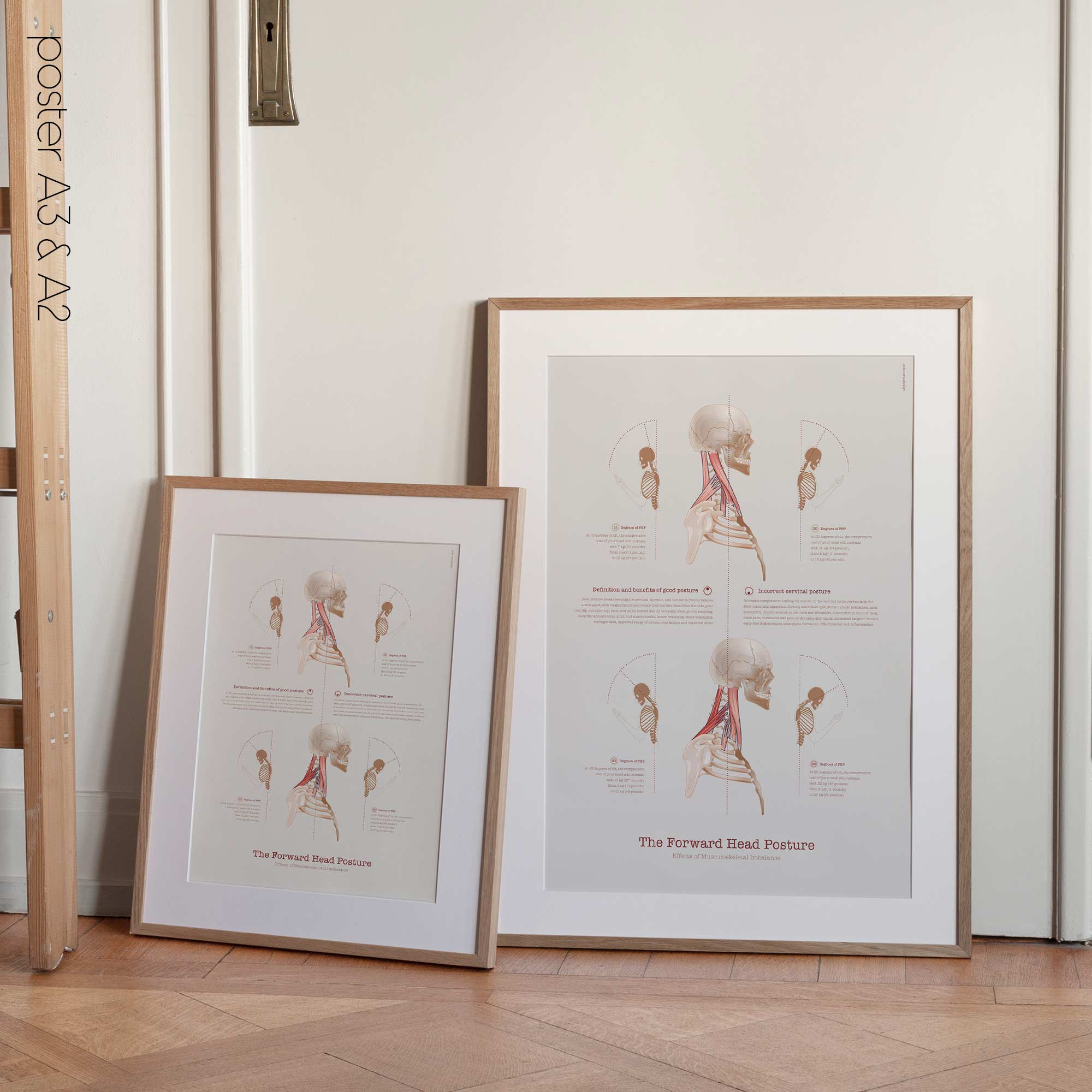 Forward Head Posture chart