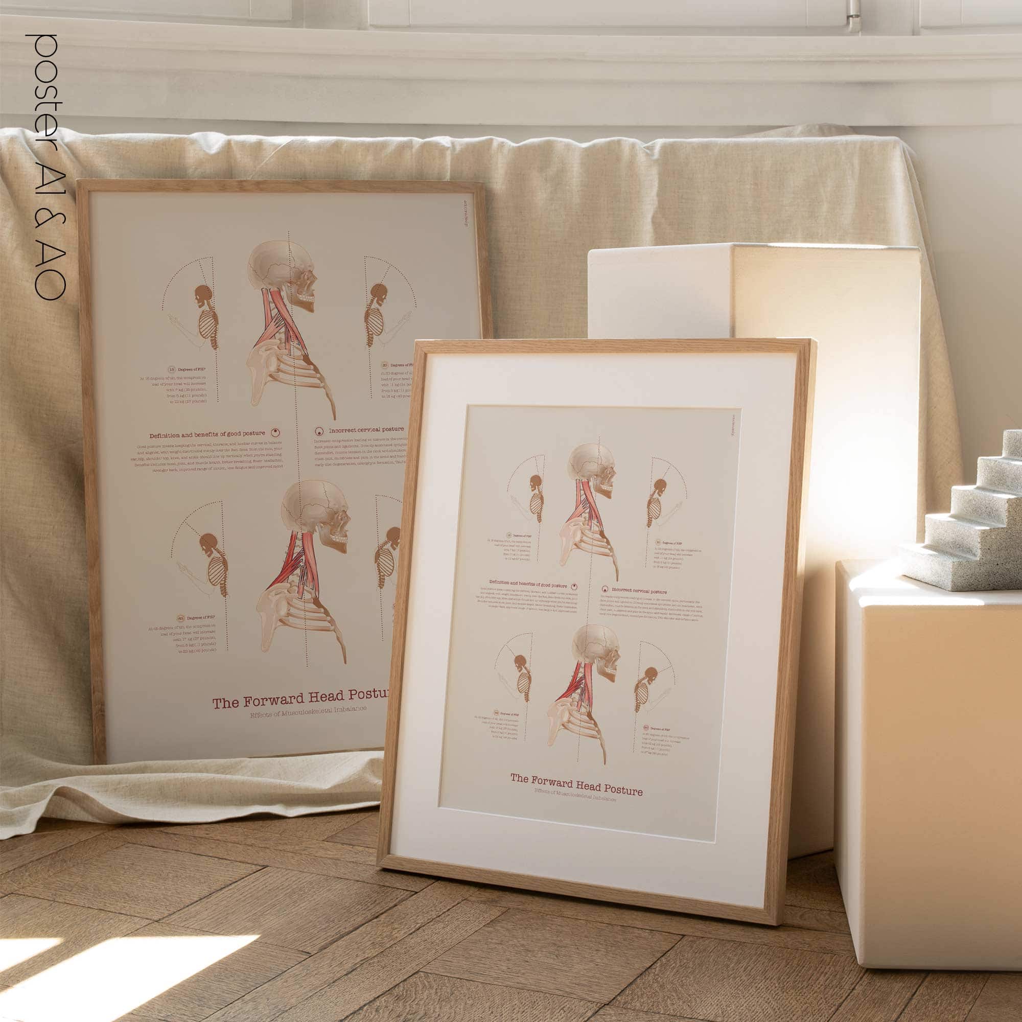 Forward Head Posture chart