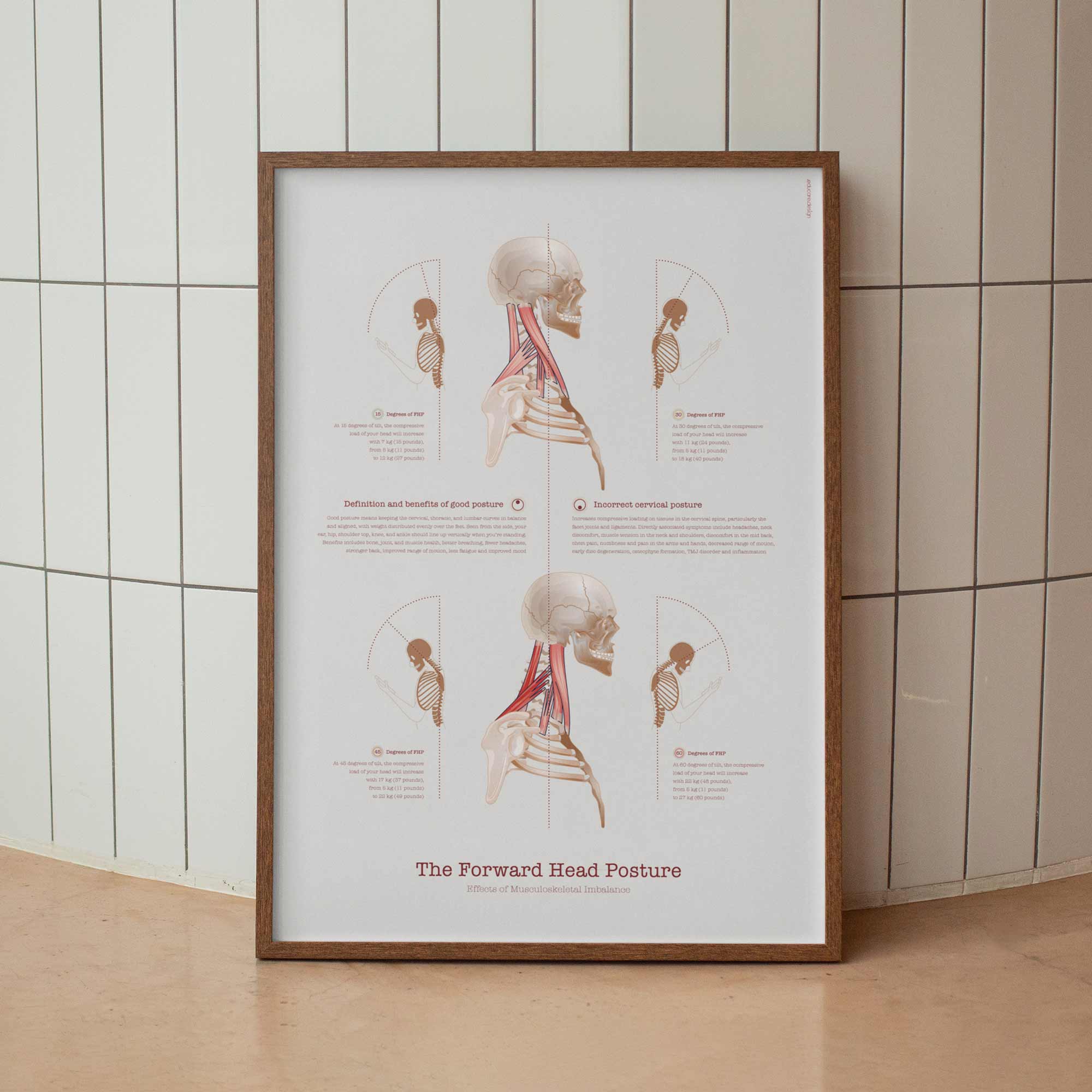 Forward Head Posture chart